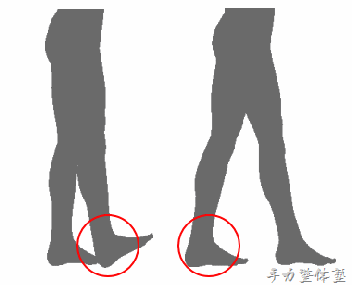 足関節の背屈