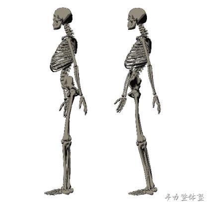 反り腰という表現ではどちらも同じ